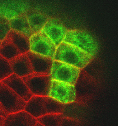 Expression de la protéine fluorescente GFP - détail