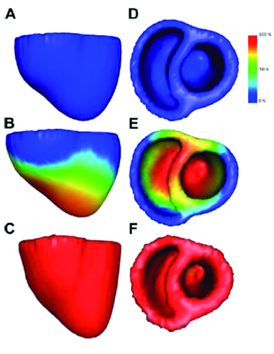  Simulation de la contraction des 2 ventricules cardiaques depuis la phase de remplissage vers la phase d'éjection
